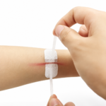 Self-Adhesive Wound Strips for Skin Closure – 40 Pieces - Image 2